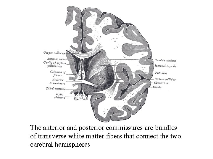 The anterior and posterior commissures are bundles of transverse white matter fibers that connect