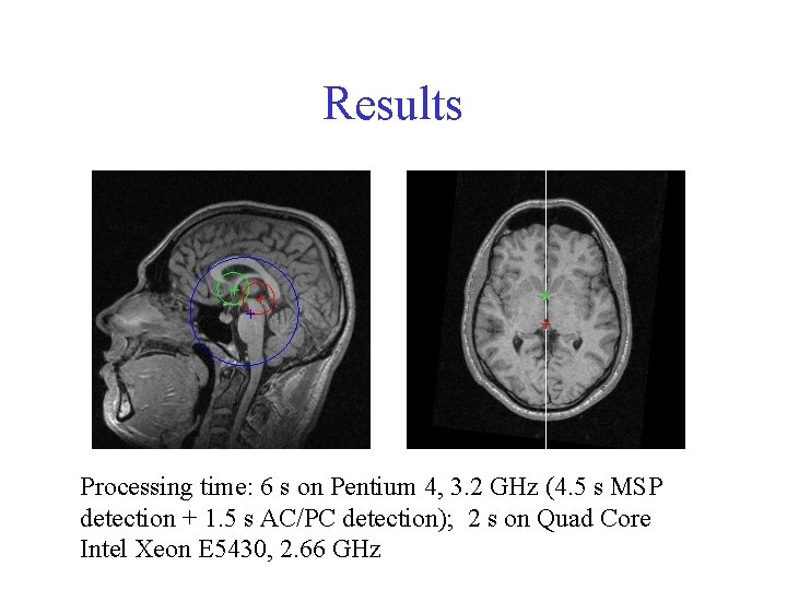 Results Processing time: 6 s on Pentium 4, 3. 2 GHz (4. 5 s