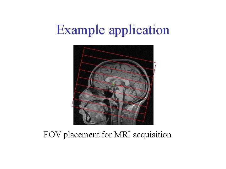 Example application FOV placement for MRI acquisition 