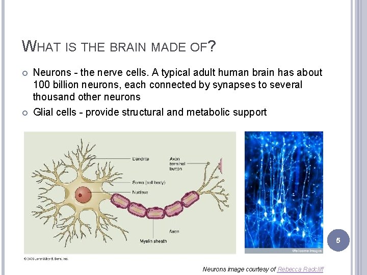 WHAT IS THE BRAIN MADE OF? Neurons - the nerve cells. A typical adult