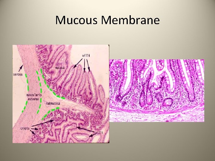 Mucous Membrane 