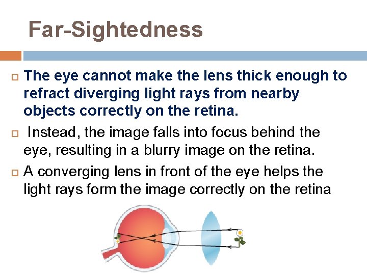 Far-Sightedness The eye cannot make the lens thick enough to refract diverging light rays