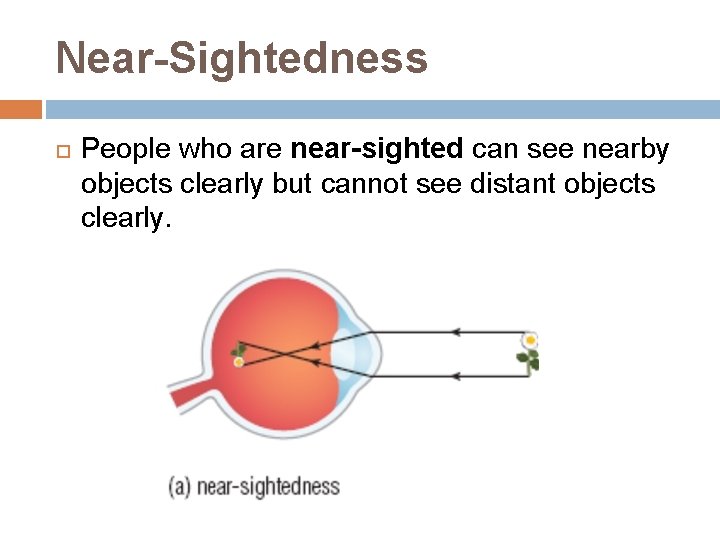 Near-Sightedness People who are near-sighted can see nearby objects clearly but cannot see distant