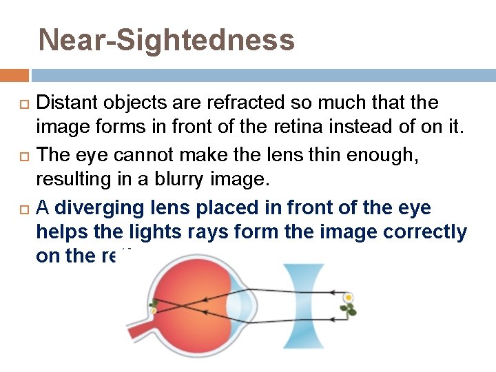 Near-Sightedness Distant objects are refracted so much that the image forms in front of