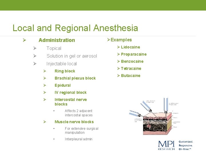 Local and Regional Anesthesia Ø Administration ØExamples Ø Topical Ø Lidocaine Ø Solution in