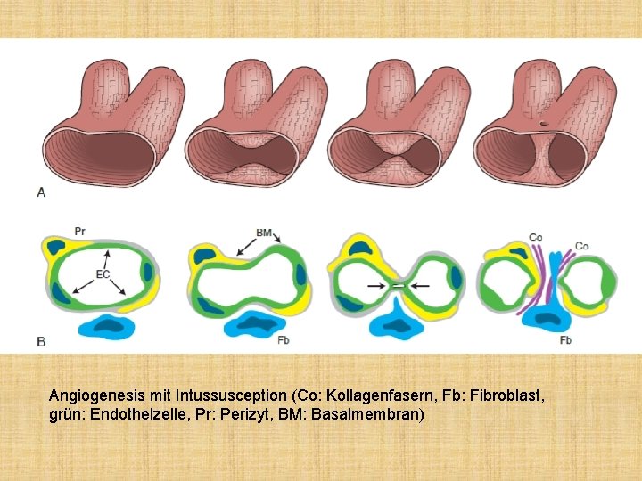 Angiogenesis mit Intussusception (Co: Kollagenfasern, Fb: Fibroblast, grün: Endothelzelle, Pr: Perizyt, BM: Basalmembran) 