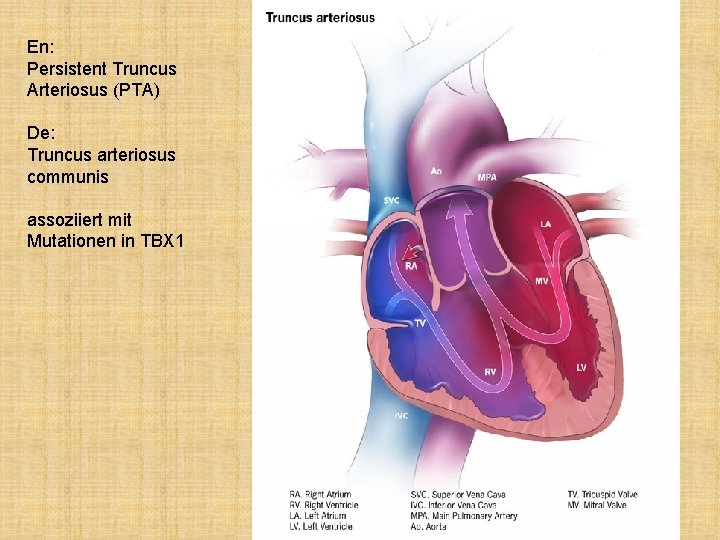 En: Persistent Truncus Arteriosus (PTA) De: Truncus arteriosus communis assoziiert mit Mutationen in TBX