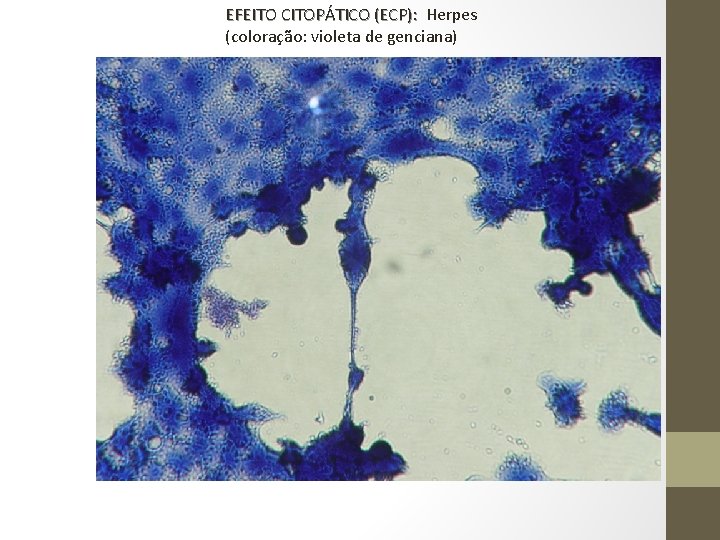 EFEITO CITOPÁTICO (ECP): Herpes (coloração: violeta de genciana) 