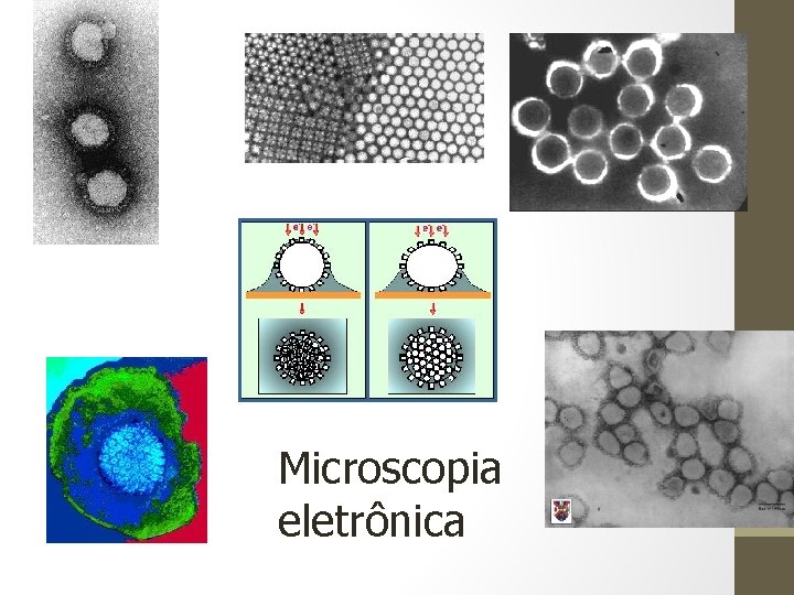 Microscopia eletrônica 