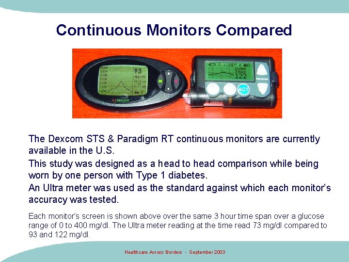 Continuous Monitors Compared The Dexcom STS & Paradigm RT continuous monitors are currently available