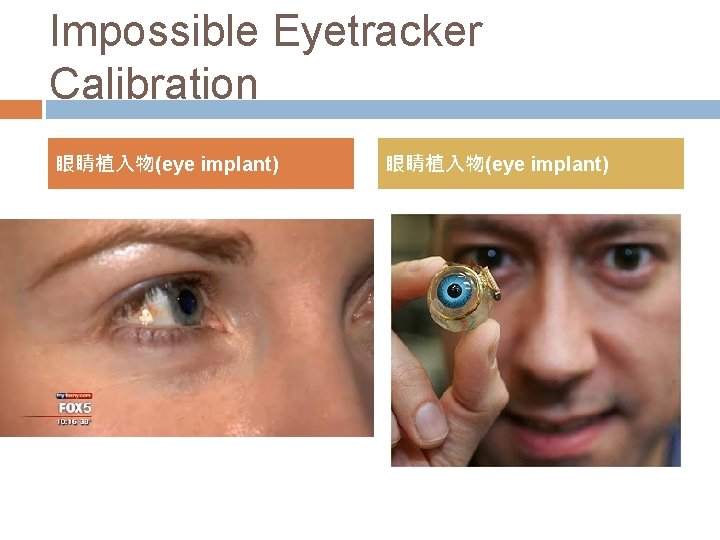 Impossible Eyetracker Calibration 眼睛植入物(eye implant) 