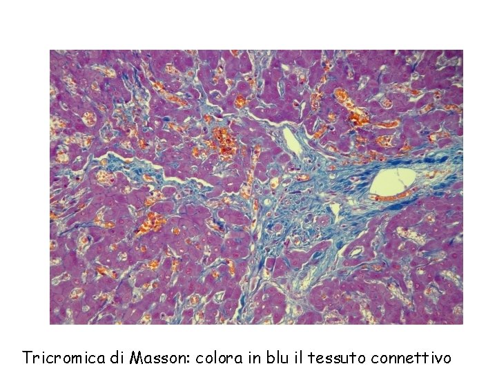 Tricromica di Masson: colora in blu il tessuto connettivo 