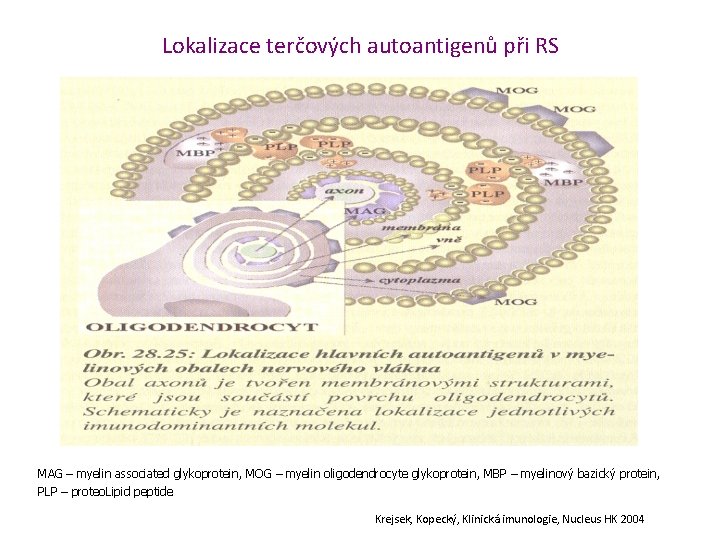 Lokalizace terčových autoantigenů při RS MAG – myelin associated glykoprotein, MOG – myelin oligodendrocyte