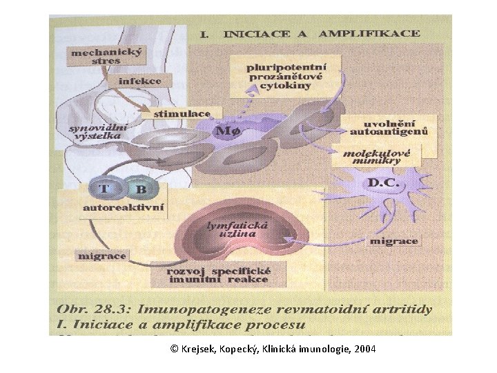 © Krejsek, Kopecký, Klinická imunologie, 2004 