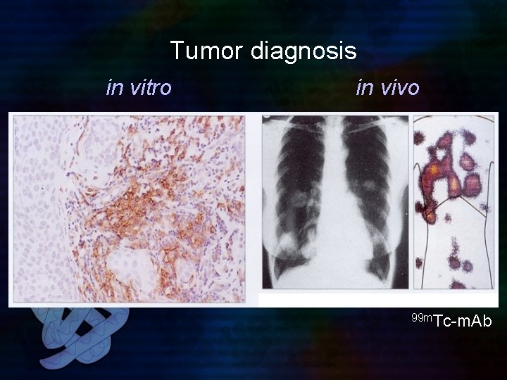 Tumor diagnosis in vitro in vivo 99 m. Tc-m. Ab 