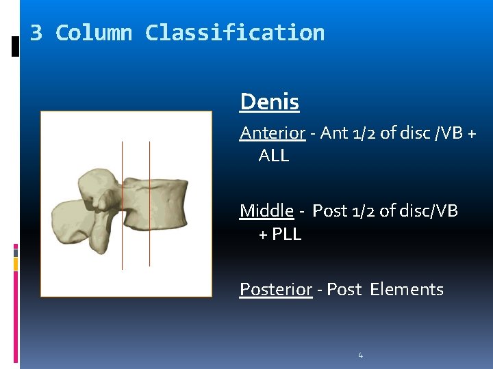 3 Column Classification Denis Anterior - Ant 1/2 of disc /VB + ALL Middle