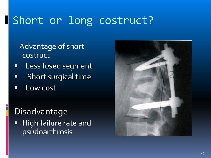 Short or long costruct? Advantage of short costruct Less fused segment Short surgical time