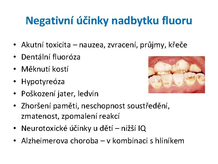 Negativní účinky nadbytku fluoru Akutní toxicita – nauzea, zvracení, průjmy, křeče Dentální fluoróza Měknutí