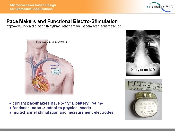 Pace Makers and Functional Electro-Stimulation http: //www. hgcardio. com/HRhythm/Treatments/a_pacemaker_schematic. jpg ● current pacemakers have