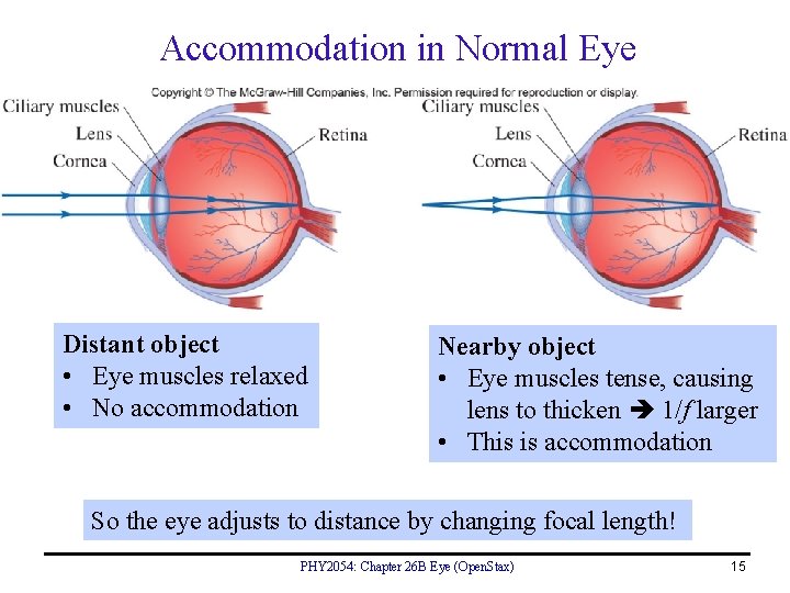 Accommodation in Normal Eye Distant object • Eye muscles relaxed • No accommodation Nearby