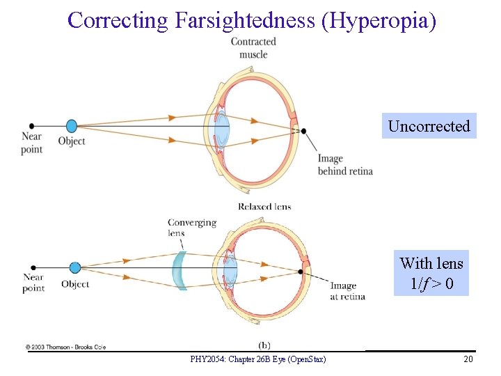 Correcting Farsightedness (Hyperopia) Uncorrected With lens 1/f > 0 PHY 2054: Chapter 26 B