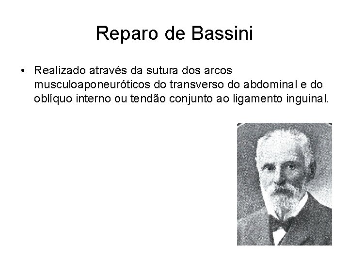 Reparo de Bassini • Realizado através da sutura dos arcos musculoaponeuróticos do transverso do