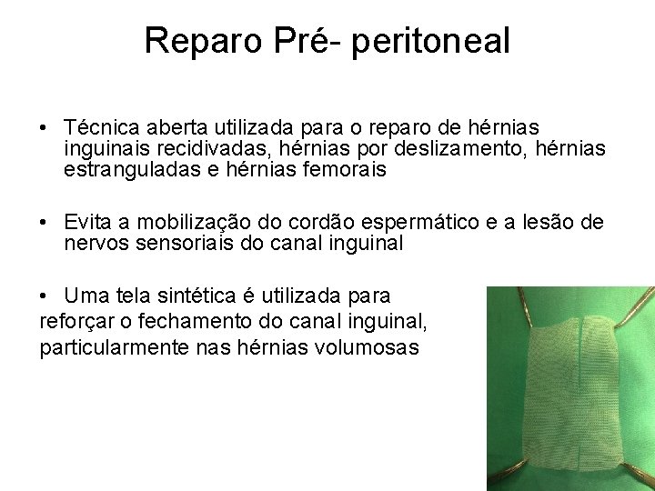 Reparo Pré- peritoneal • Técnica aberta utilizada para o reparo de hérnias inguinais recidivadas,