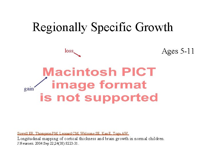 Regionally Specific Growth loss Ages 5 -11 gain Sowell ER, Thompson PM, Leonard CM,