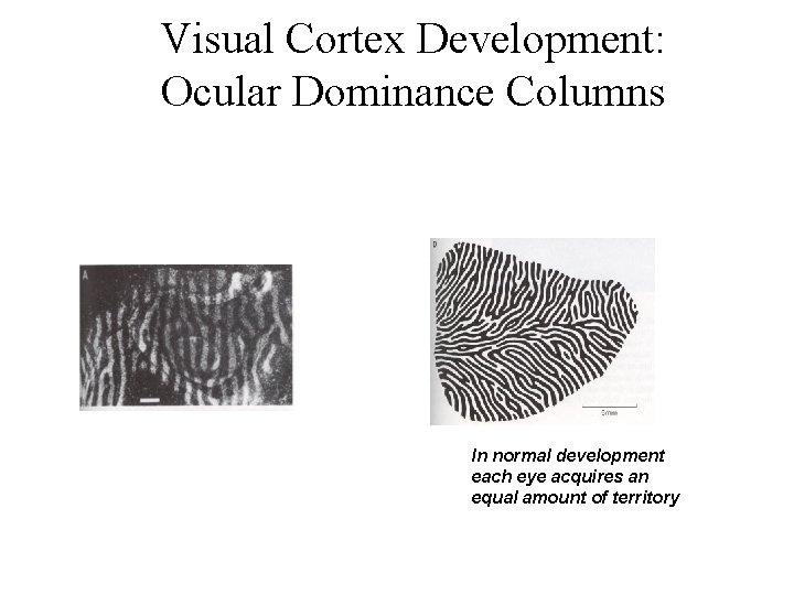 Visual Cortex Development: Ocular Dominance Columns In normal development each eye acquires an equal