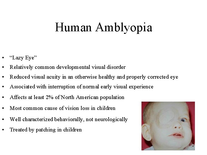 Human Amblyopia • “Lazy Eye” • Relatively common developmental visual disorder • Reduced visual