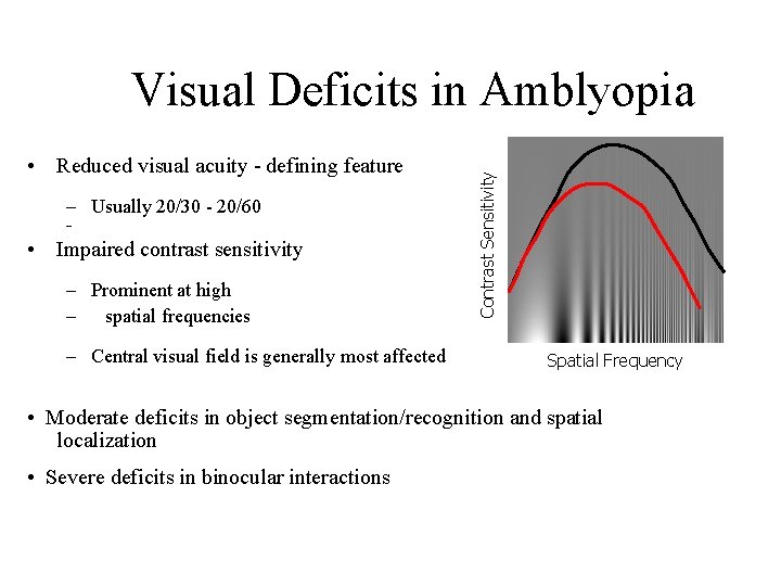  • Reduced visual acuity - defining feature – Usually 20/30 - 20/60 –