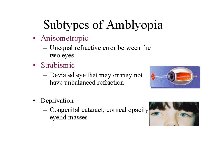 Subtypes of Amblyopia • Anisometropic – Unequal refractive error between the two eyes •