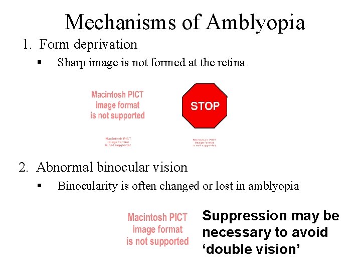 Mechanisms of Amblyopia 1. Form deprivation § Sharp image is not formed at the