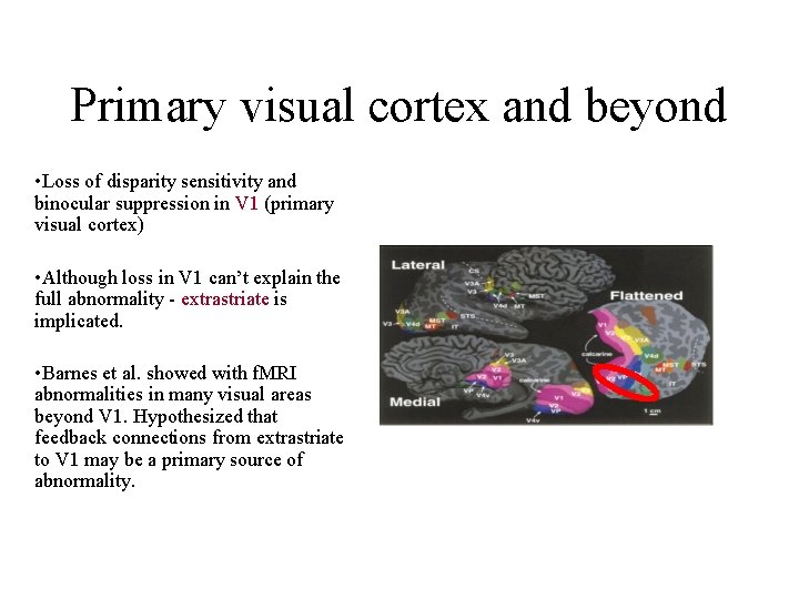 Primary visual cortex and beyond • Loss of disparity sensitivity and binocular suppression in