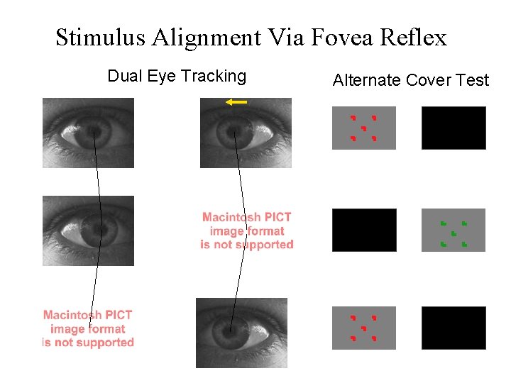 Stimulus Alignment Via Fovea Reflex Dual Eye Tracking Alternate Cover Test 