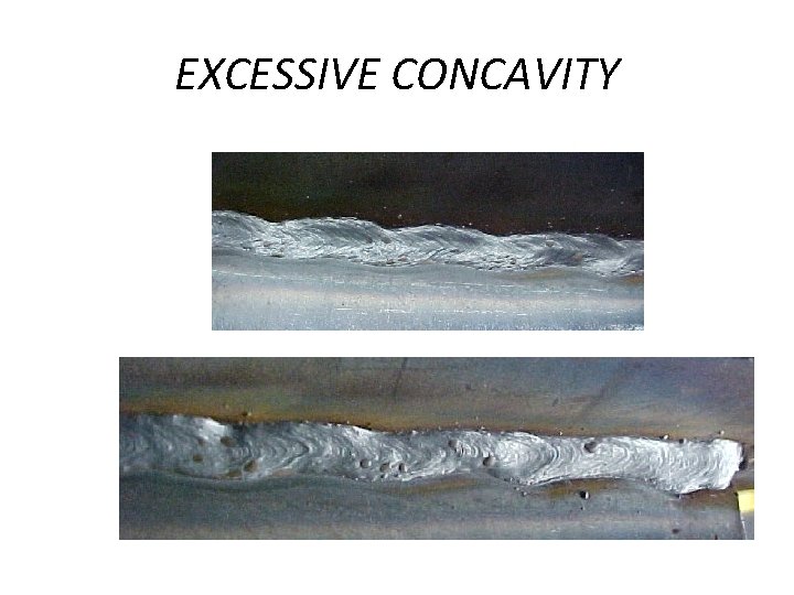 EXCESSIVE CONCAVITY 
