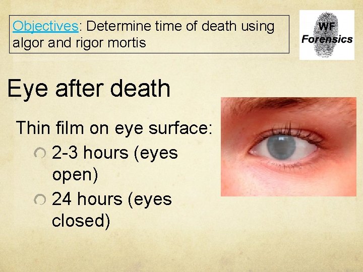 Objectives: Determine time of death using algor and rigor mortis Eye after death Thin