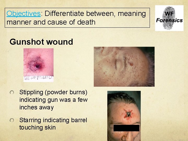 Objectives: Differentiate between, meaning manner and cause of death Gunshot wound Stippling (powder burns)