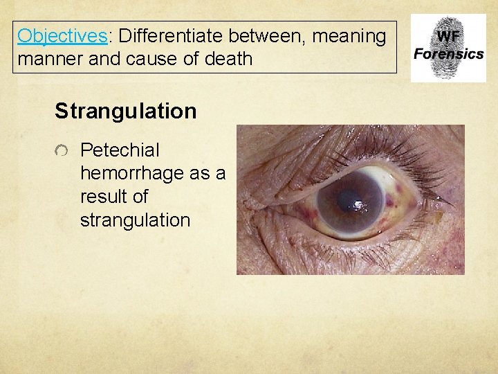 Objectives: Differentiate between, meaning manner and cause of death Strangulation Petechial hemorrhage as a