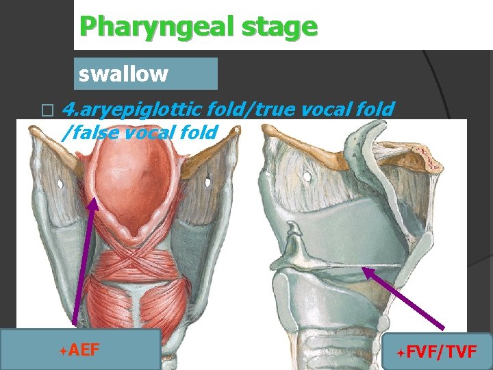 Pharyngeal stage swallow � 4. aryepiglottic fold/true vocal fold /false vocal fold ªAEF ªFVF/TVF