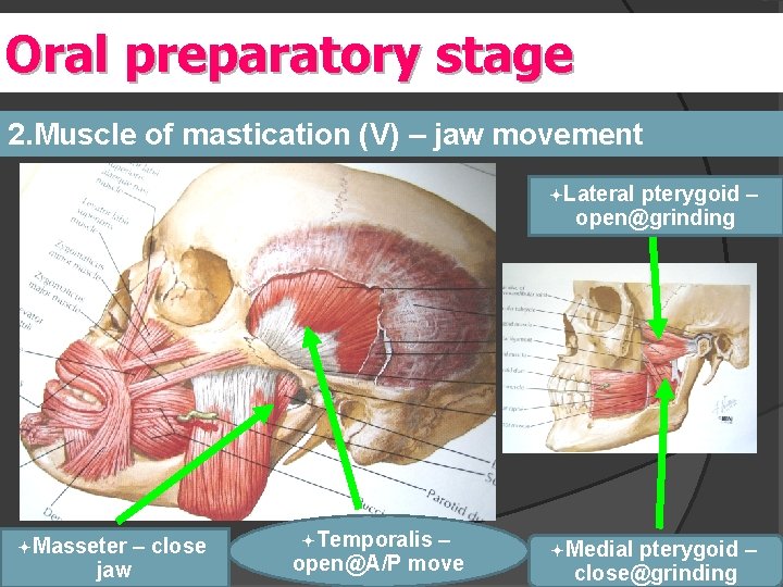 Oral preparatory stage 2. Muscle of mastication (V) – jaw movement ªLateral pterygoid –