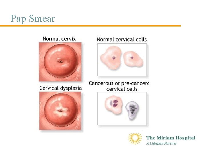 Pap Smear 