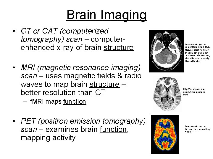 Brain Imaging • CT or CAT (computerized tomography) scan – computerenhanced x-ray of brain