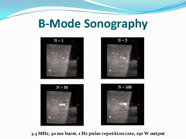 B-Mode Sonography N=1 N = 50 N=5 N = 100 3. 3 MHz, 30