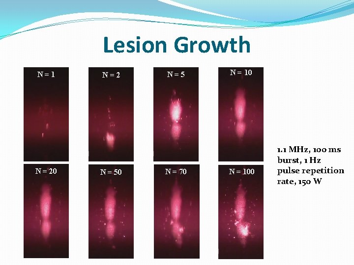 Lesion Growth N=1 N = 20 N=2 N = 50 N=5 N = 70