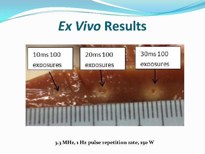 Ex Vivo Results 3. 3 MHz, 1 Hz pulse repetition rate, 150 W 