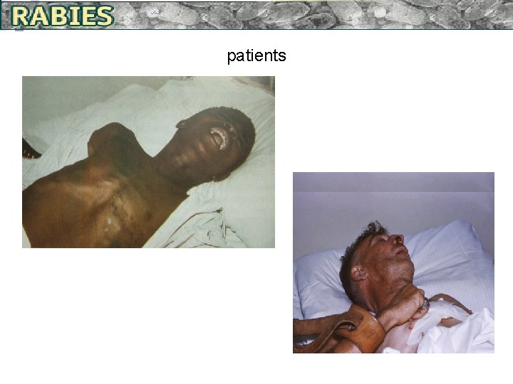 patients ¨ patients 