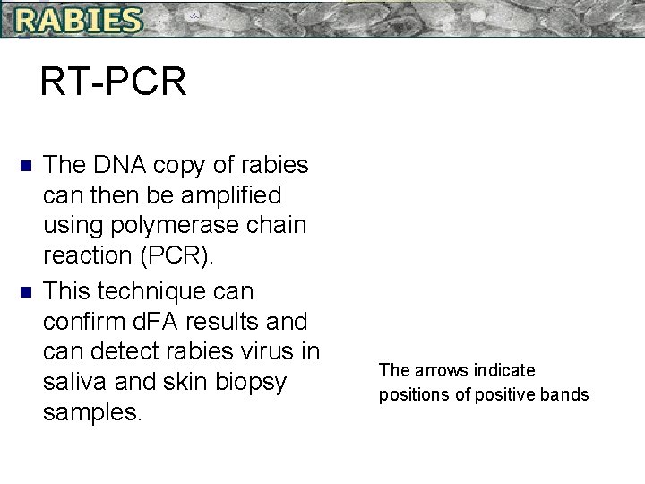 RT-PCR n n The DNA copy of rabies can then be amplified using polymerase