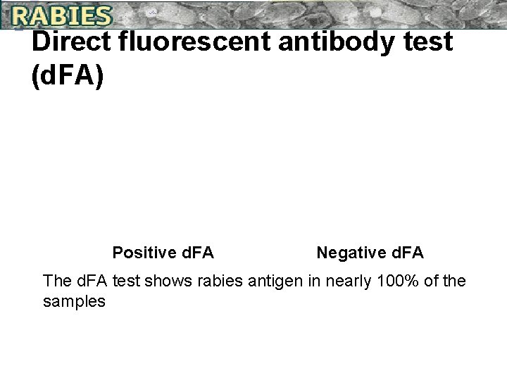 Direct fluorescent antibody test (d. FA) Positive d. FA Negative d. FA The d.