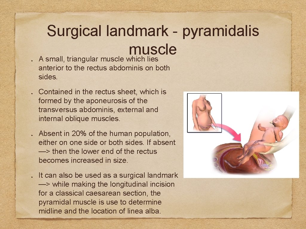 Surgical landmark - pyramidalis muscle A small, triangular muscle which lies anterior to the